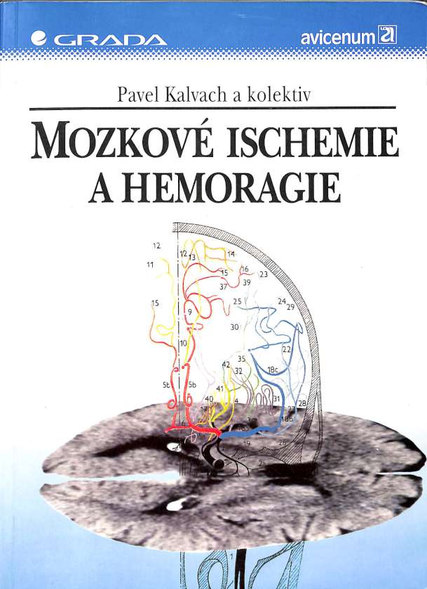 Mozkov ischemie a hemoragie