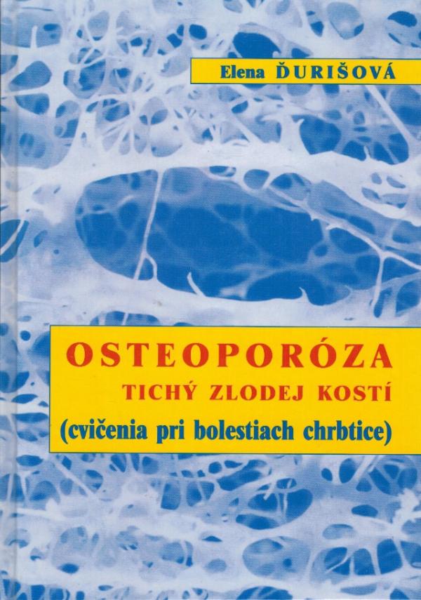 Osteoporza. Tich zlodej kost